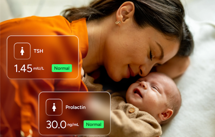 Check in on your hormones like TSH and prolactin